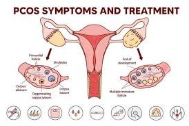 best nutritionists with pcos diet in santacruz west