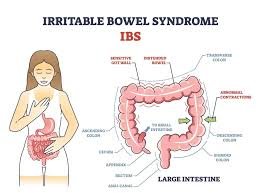 IBS & Constipation Dietician| Vile Parle | Mumbai | Online Dietician