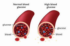 Sugar Control Diet Plan | Matunga | Mumbai | Online Nutrition Counseling
